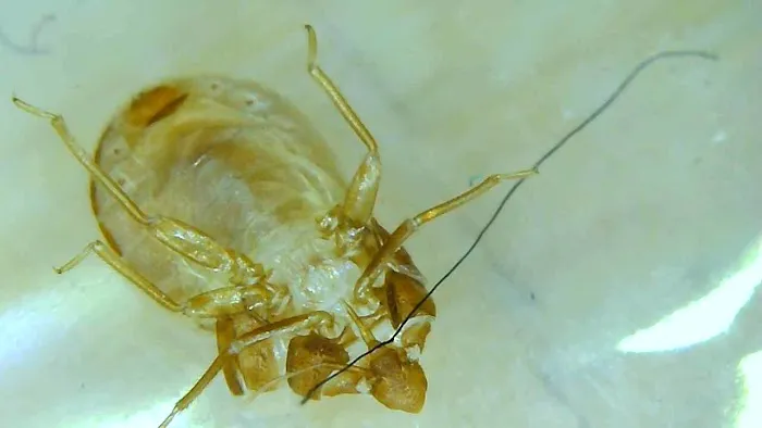 Doctor Sniffs Bed Bug Dogs Picture 1