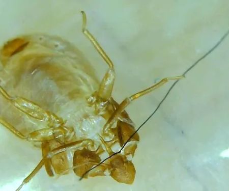 Doctor Sniffs Bed Bug Dogs