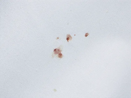 EZ Bed Bug Exterminator NYC Picture 2