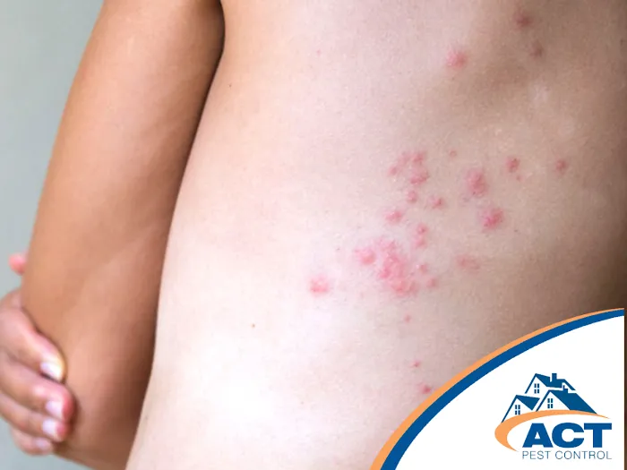 Act Pest Control Picture 10