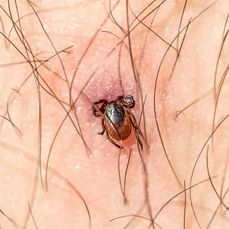 Big Blue Bug Solutions Picture 7